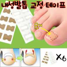 케이앤케이 내성발톱교정기 엄지발가락교정 내성발톱교정테이프 60P, 6매