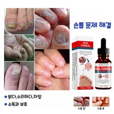 발톱무좀연고 TOP01