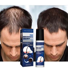 머리카락 발모제 남자 수염 발모제 증진 모발 활력, 2개, 60ml