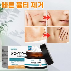 [일본 기술 1/1+1특가] 흉터 제거 연고 재생 크림 화상 수술 상처 치료 재생연고 조상증정