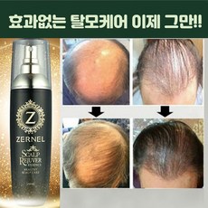 탈모영양제