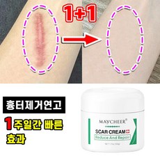 [빠른배송] 1+1 흉터 제거 연고 수술 상처 화상 피부 흉터 크림 제왕절개 흉터 관리 포장증정