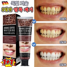 hismile 치약 [효과보장] 독일 1/1+1 미백치약 치아미백제 화이트닝 커피/담배 치아 강력 미백 2개 100ml