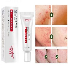 아젤라산 젤 크림 제거 부드럽게 15% 연고 30g