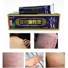 피부 용 항소 양 연고 크림 15g