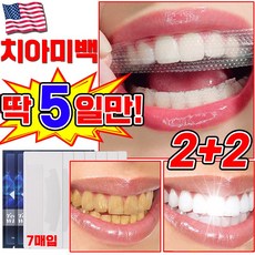 [국내배송] 미국 1/1+1/2+2 치아 미백 패치 셀프 치아미백 제 화이트닝 얼룩 제거 스티커, 4세트, 26g