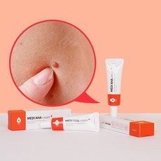 메디스팟크림