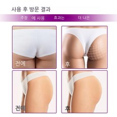 상떼수더겔
