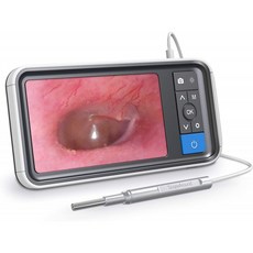ScopeAound Ear Wax Removal Endosc Earwax Remover Tool Ear Camera 1080P HD 카메라 이어 오토스코프 LED 조명 6개 이, 단일옵션