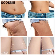 SODSNIE 셀룰라이트크림 지방분해크림 피하지방 제거, 60g, 2개