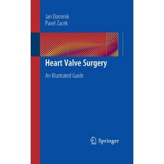 Heart Valve Surgery: An Illustrated Guide Paperback, Springer