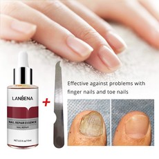LANBENA 1+1 발톱무좀치료 발톱무좀 진균 리페어에센스 조갑사상균증 손발톱 강화리페어, 15ML