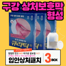 넣입밴드