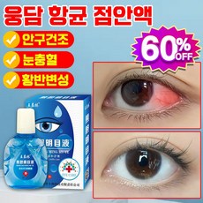 [빠른 배송] 웅담 항균 점안액 안구건조증 황반변성 노안 완화 결명자 눈 피로 점안액 아이 케어 안약