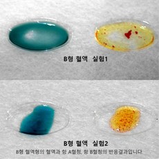 혈액형판정실험