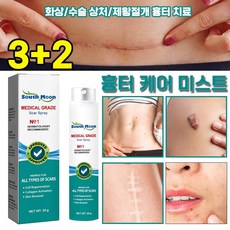 [피부과 전용] 흉터 케어 미스트 수술흉터 화상물집 쌍꺼풀흉터 제왕절개흉터 흉터제거연고 재생크림 과민성 흉터/흉터 증식 여드름흉터