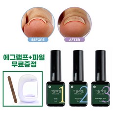내성발톱젤 TOP01