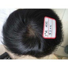 남자붙이는가발