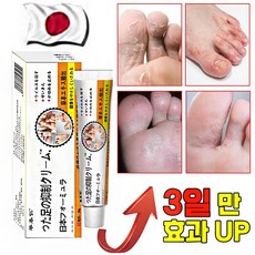 [국내배송 1/1+1특가] 발 가려움증 완화 연고 발냄새 제거 발각질 문제성발 제거 크림