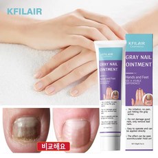 KFILAIR 발톱 무좀 손발톱 케어 크림 풋 리페어 크림 발톱 트러블 솔루션, 1개, 20g - 수운수