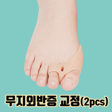 무지외반증연고