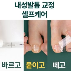 뇌성발톱