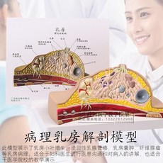 여성 유방 가슴 모형 해부학 모델 데모 수유 단면 데셍 스케치, 테이블 병리학 유방