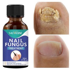 nailfungus