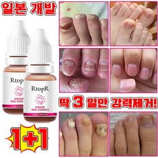 [당일 배송] 1+1/2+2 손톱 발톱 무좀 앰플 발톱 영양제 문제성 발톱 케어 효과보장/선물 랜덤 증정, 2개, 10ml - 레오클린