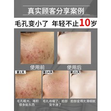 수축 모공 굵다 슬림 막히는 심층 청결 팽팽 당기기 신기 축소 페이스 세럼 남성 여성, 240ml