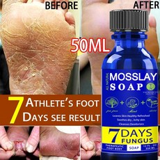 캘러스필미스트