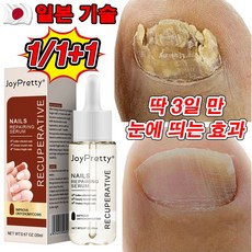 [효과보장] 손톱 발톱 강화 무좀 문제성 무좀 전문 영양제 100% 효과 있음, 1개, 20ml - 큐티클제거액