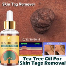 쥐젖밴드