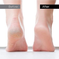 그랏사 풋크림포함 실리콘 발세척매트 풋브러쉬 발각질제거 발스크럽 발바닥지압, 1개, 실리콘풋브러쉬_민트