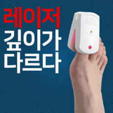 발톱무좀레이저