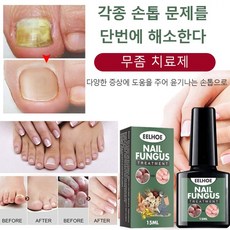 발무좀치료제