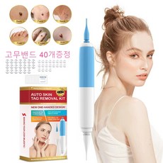 눈가비립종셀프제거