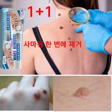 [한국셀러] jaysuing1+1 미국 약 제거약 천연성분 손가락 치료 피부치료, 1개, 20g