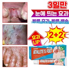 [빠른배송]발톱 무좀 치료 발 가려움증 완화 발냄새 제거 연고 발각질 풋 케어 문제성발 제거 크림