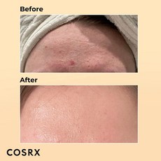 달팽이 무신 96% 파워 리페어 에센스 세럼 피부 회복 스킨 케어 100ml, 1개