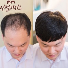 인텔리위그 남자가발 100%인모 불파트 나노스킨가발, S(17x19), 1개
