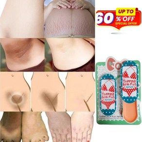[태국핫템] 색소침착 멜라토닝 핑크 크림 무릎 겨드랑이 튼살 천연 멜라닌크림 y존 멜라닌 엉덩이 팔꿈치 사타구니 톤업 미백 멜라닌 억제 바디 미백크림, 1개, 30g