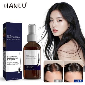 HANLU 가려움증 및 건조한 두피 케어 가지모발 개선 로즈마리 헤어 에센스 두피 영양제 헤어 에센스 영양 케어, 1개, 30ml