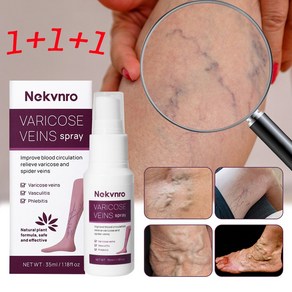 Nekvno 하지정맥 스프레이 정맥 정맥류 케어 다리마사지 붓기빼는약, 3개, 35ml