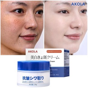 AKOLA 기미 잡티 주근깨 제거 크림 얼굴 색소침착 개선 화이트닝 & 주름 케어, 1개, 30g