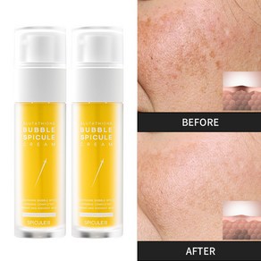 스피큘엑스 비타민 케어 히알루론산 미세 버블 조명 글루타치온 스피큘 크림, 2개, 50ml