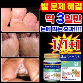 [빠른배송] 발 연고 발 가려움 발냄새 발각질 제거 크림 억제 포장증정, 2세트, 50g