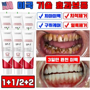 미국 SP7 미백 치약 1+1 치아미백 누렁니제거 입냄새제거 치석케어 구취제거 셀프치아미백 퍼플 사은품 랜덤 증정, 2개, 100ml