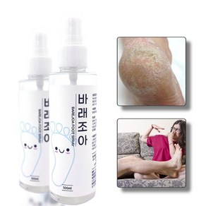 바래조아 발 각질 무좀 풋 스프레이 약100ml