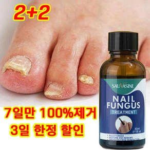 [100% 제거/국내배송] 손톱 발톱 리페어 에센스 발톱영양제 문제성발톱 앰플 발톱무좀 내성발톱, 4개, 30ml